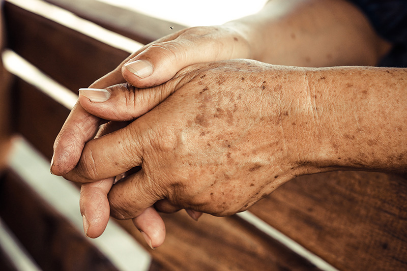 How can I improve the look of my aging hands?