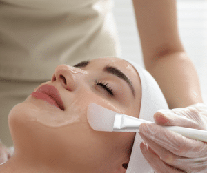 Exfoliate Dead Skin with Chemical Peels